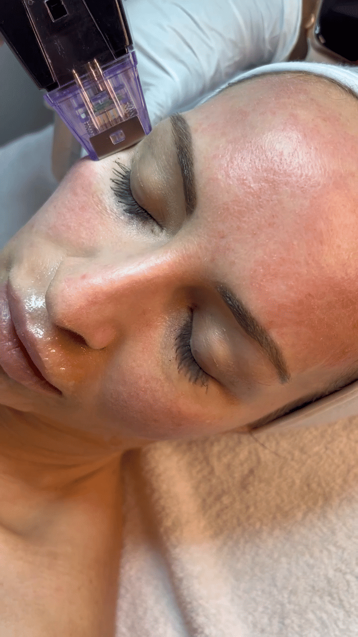 Media Poster