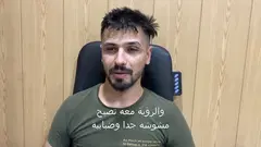 زرع قرنية سطحي لمريض من العراق