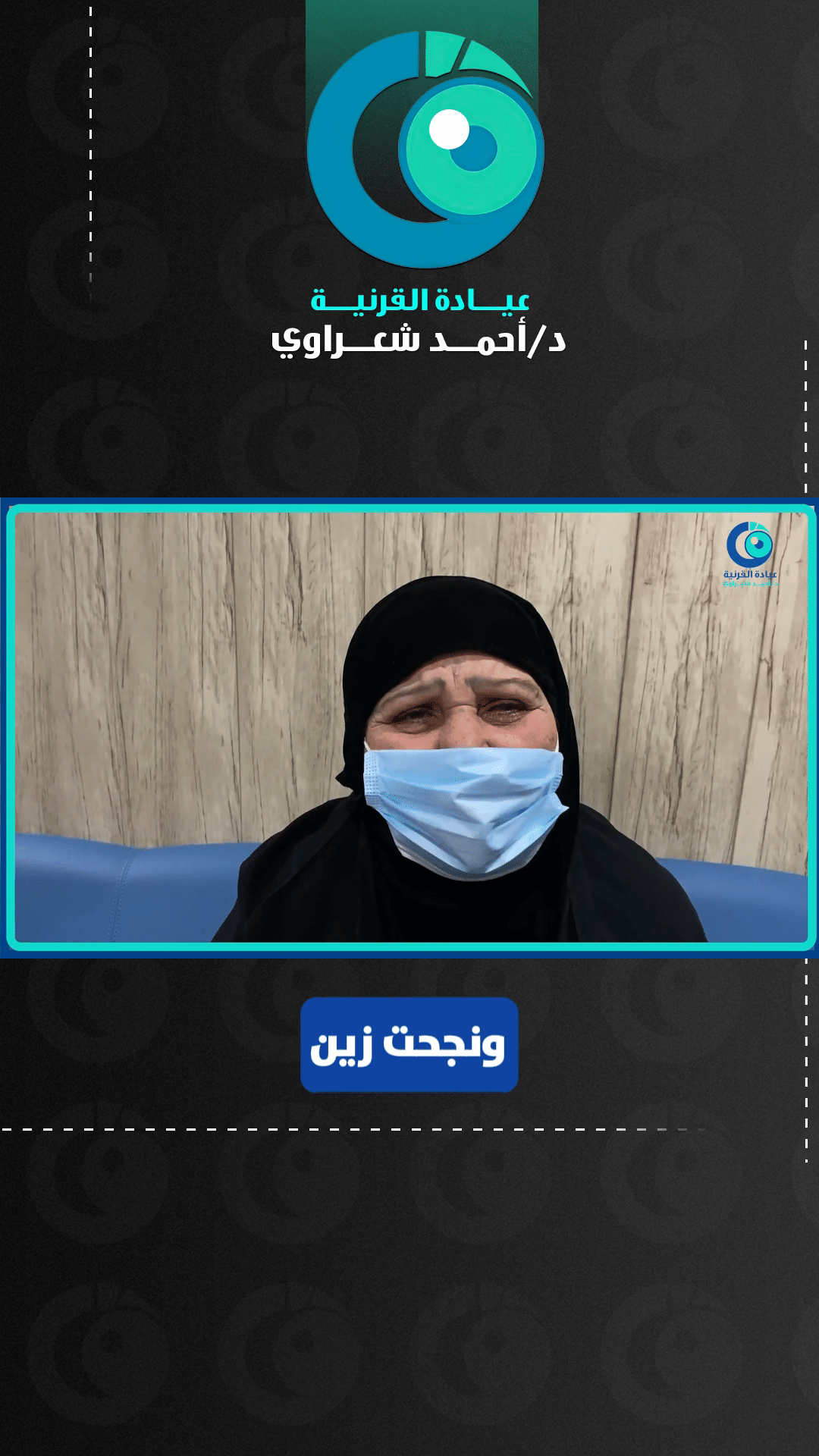 رأي مريض — زراعة القرنية الخلفية