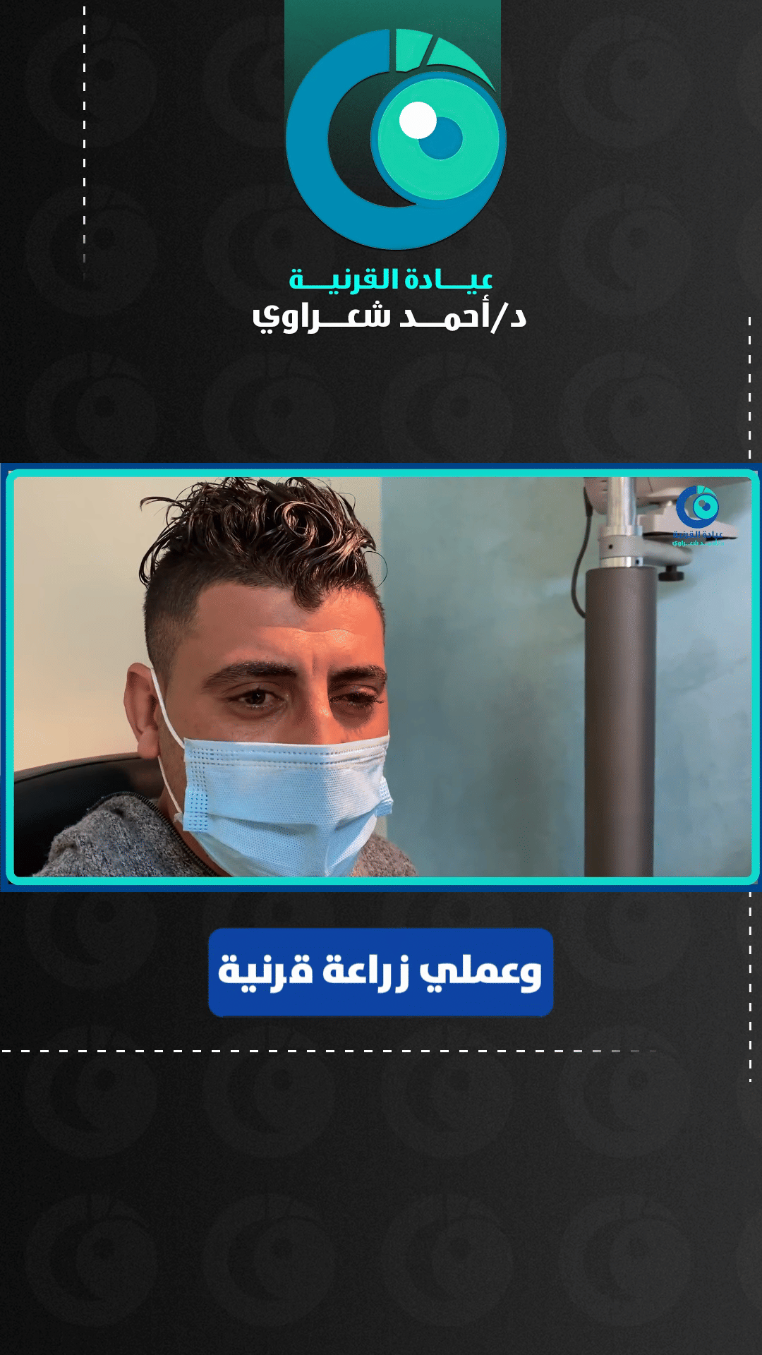 رأي مريض من البحيرة — زراعة القرنية للقرنية المخروطية