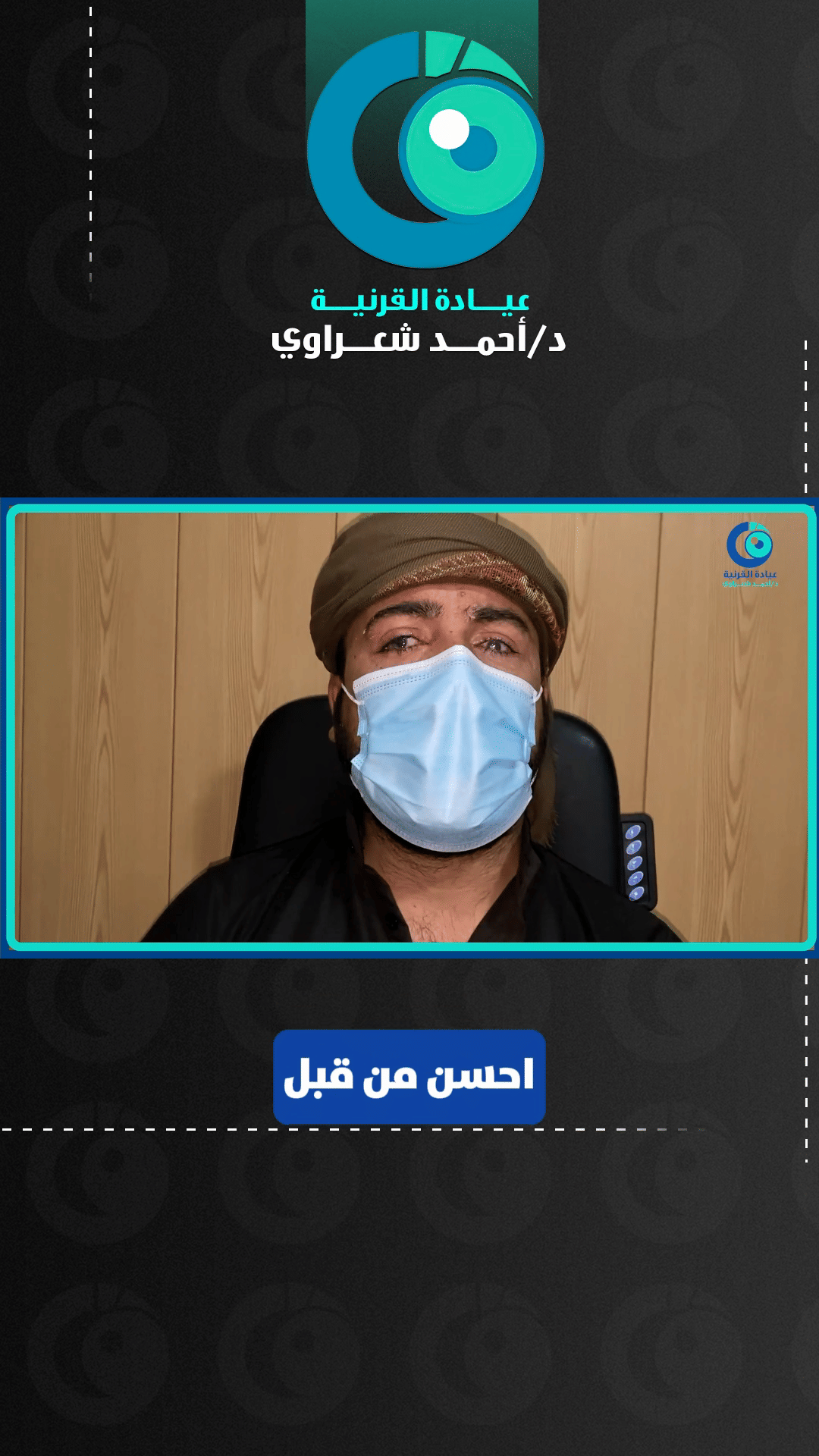 رأي مريض — تبادل القرنية بين العينين