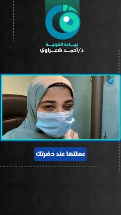 رأي مريضة — زراعة القرنية للقرنية المخروطية