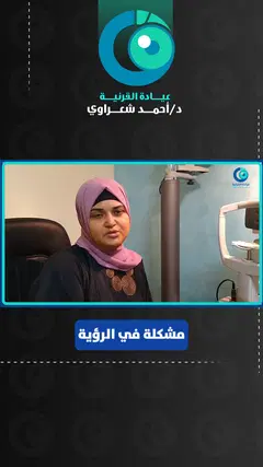 رأي مريضة من أسوان — ترقية القرنية لعلاج القرحة