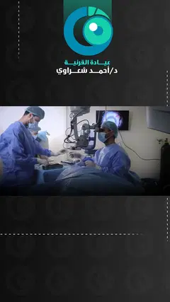 رأي مريضة — زراعة القرنية وتحسن الرؤية