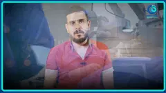 رأي مريض — علاج القرنية المخروطية بزراعة القرنية