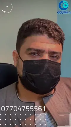 زراعة القرنية: الحل الأمثل للقرنية المخروطية والعتامات