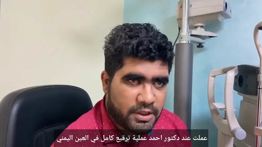 آراء مرضى من دول مختلفة — زراعة القرنية والقرنية المخروطية