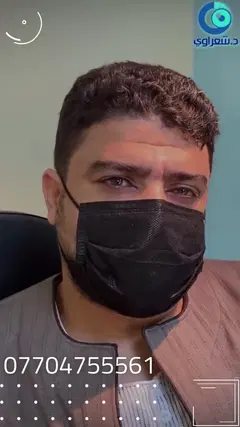 ما هي أفضل حلول جراحة القرنية المتقدمة؟