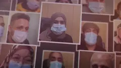 طريقة جديدة لزراعة القرنية الطبقي — تقنية تقلل مخاطر الرفض