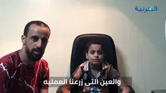 زراعة قرنية لطفل — نتائج وآمال بصرية جديدة