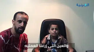 زراعة قرنية لطفل — نتائج وآمال بصرية جديدة