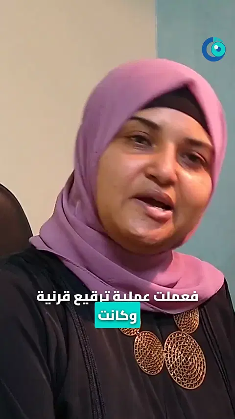 رأي مريضة بعد ترقيع القرنية لعلاج قرحة، بعد ثلاث سنوات