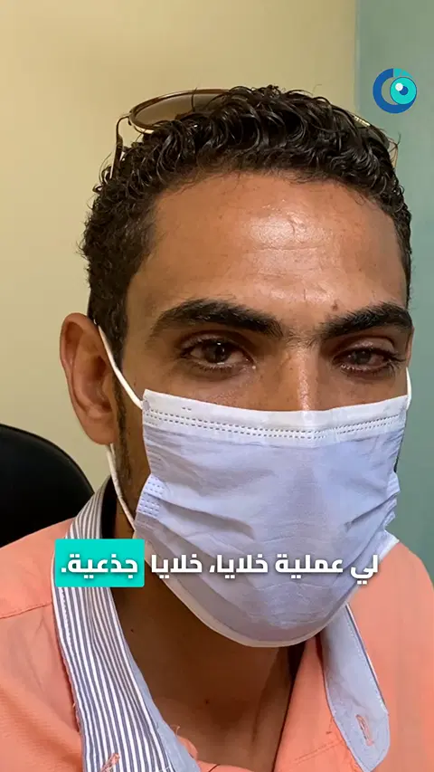 رأي مريض بعد زراعة الخلايا الجذعية السطحية لإصابة بالعين