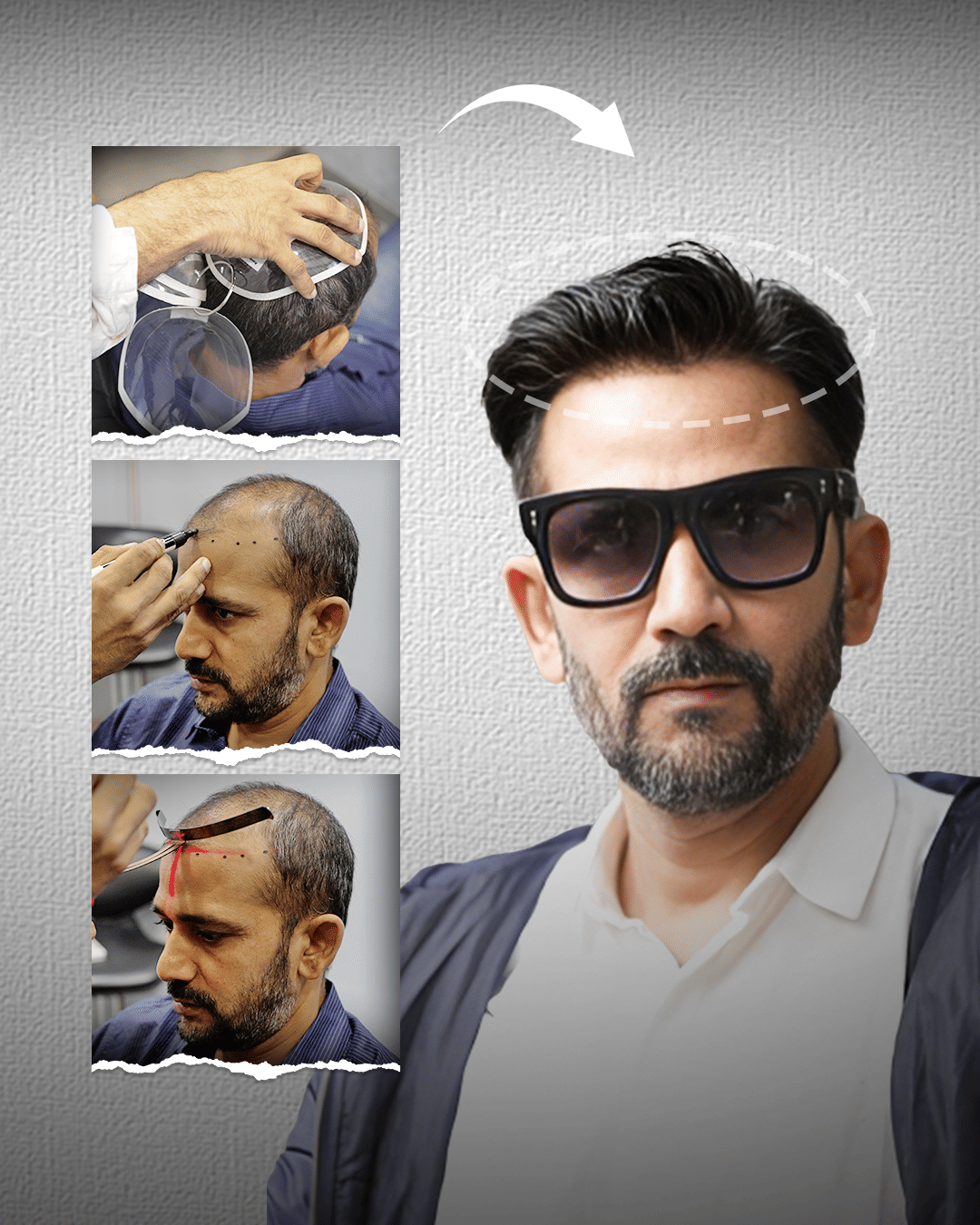 Media Poster